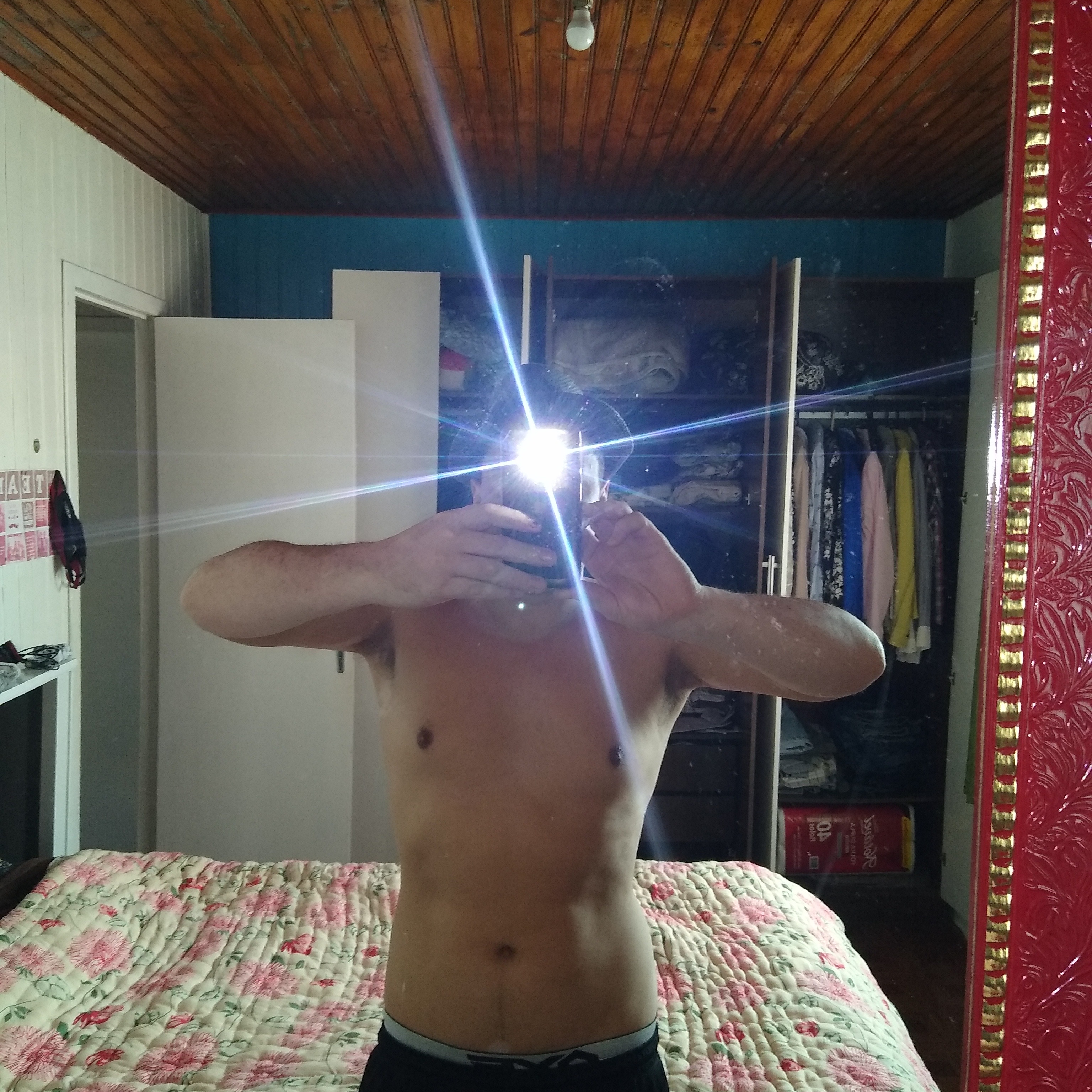 loverfans Vitiligojo profile photo. Vitiligojo 2