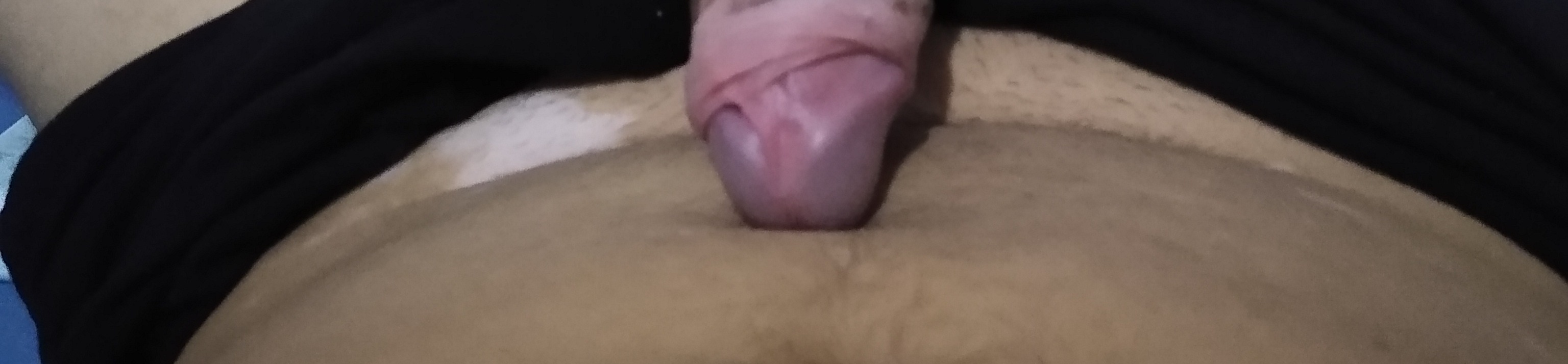 loverfans Vitiligojo profile banner